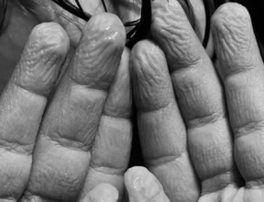 Γιατί ζαρώνουν τα δάχτυλά σας μέσα στο νερό – Όχι δεν είναι επειδή «μούλιασαν»…